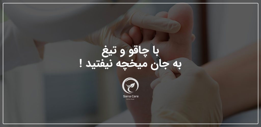 با چاقو و تیغ به جان میخچه نیفتید !