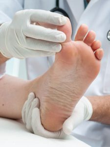 پیشگیری از بروز میخچه