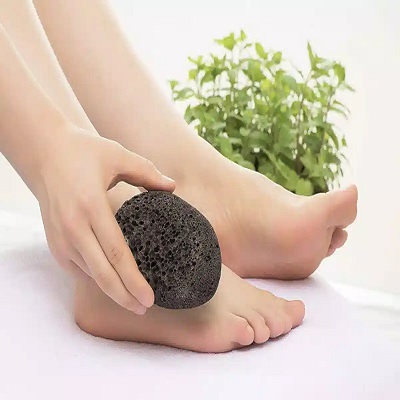پینه پا چیست و چگونه می‌توان آن را از میخچه تشخیص داد؟ (راهنمای تصویری و درمانی)